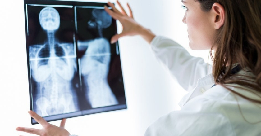 Qué es el cáncer de mama y cómo puedes reconocer sus síntomas