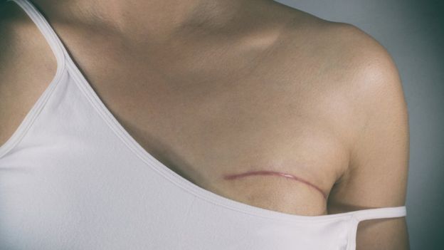 Censura en Facebook: la tatuadora de pezones para mujeres con mastectomía cuyas imágenes son constantemente bloqueadas