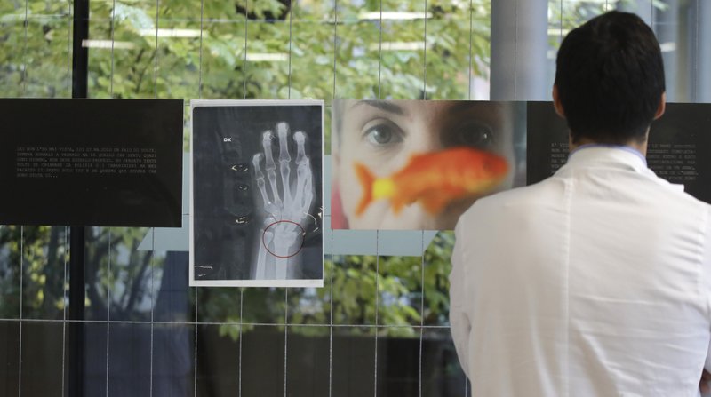 Hospital en Italia “exhibe” lesiones de mujeres agredidas por hombres