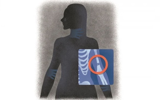 Hospitales no protegen bien a mujeres agredidas