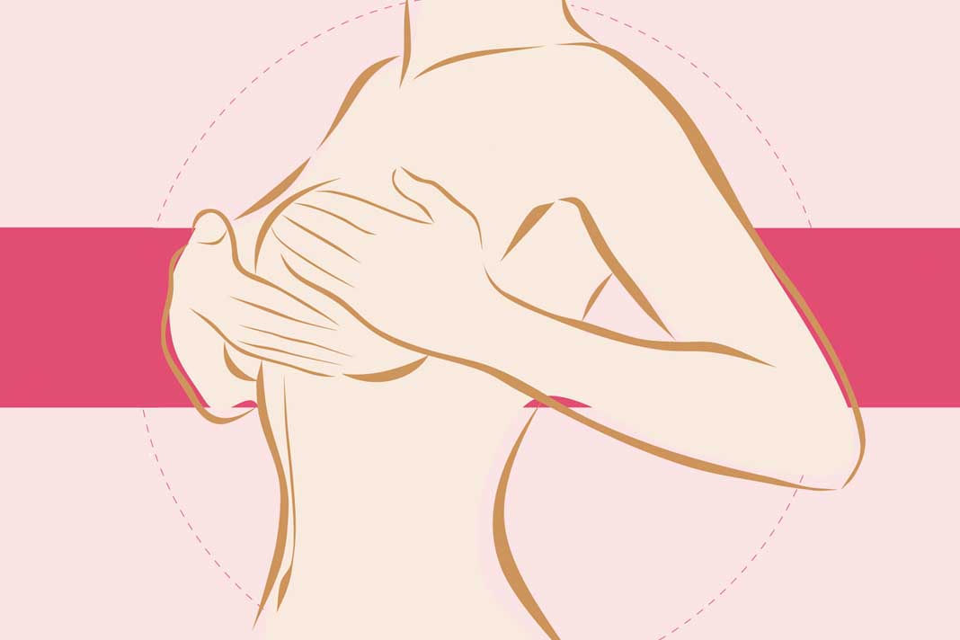 Cáncer de mama, tumor frecuente en mujeres mexicanas