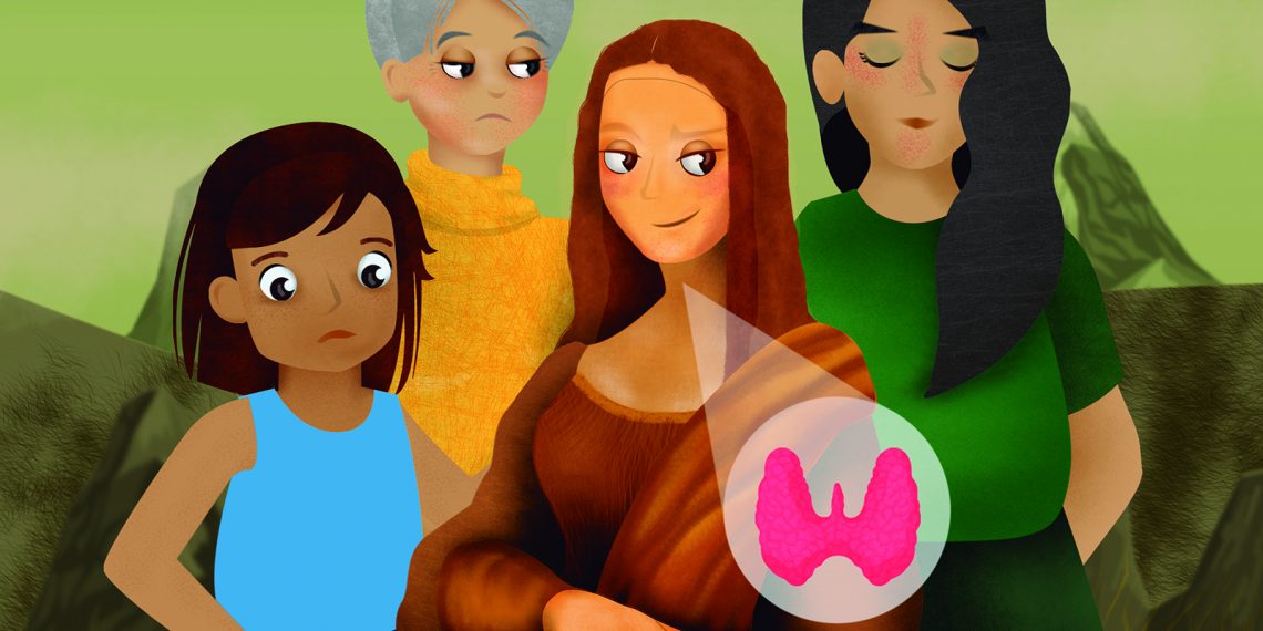 Males tiroideos, enfermedades femeninas e invisibilizadas: de la Mona Lisa a la actualidad