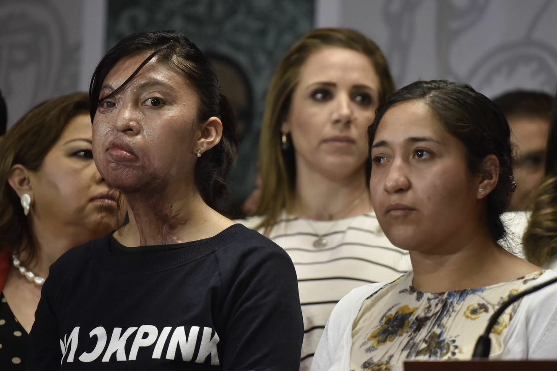 Aprueba Senado castigar hasta con 13 años de cárcel ataques con ácido a mujeres